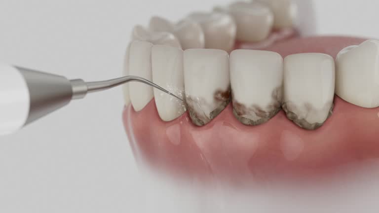 Reliable Dental Implants contractor in Montara, CA by Smile Center Dentistry